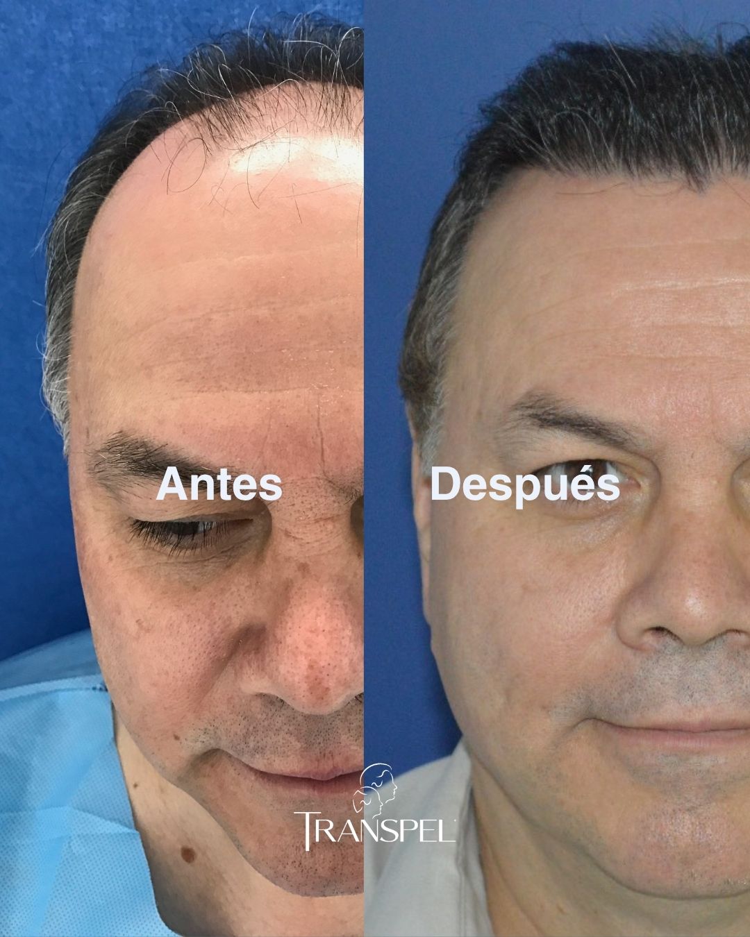 José de Jesús T José de Jesús T
